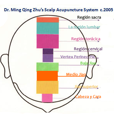 Zhu Scalp Acupuncture Pdf