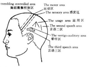 Zhu Scalp Acupuncture Pdf